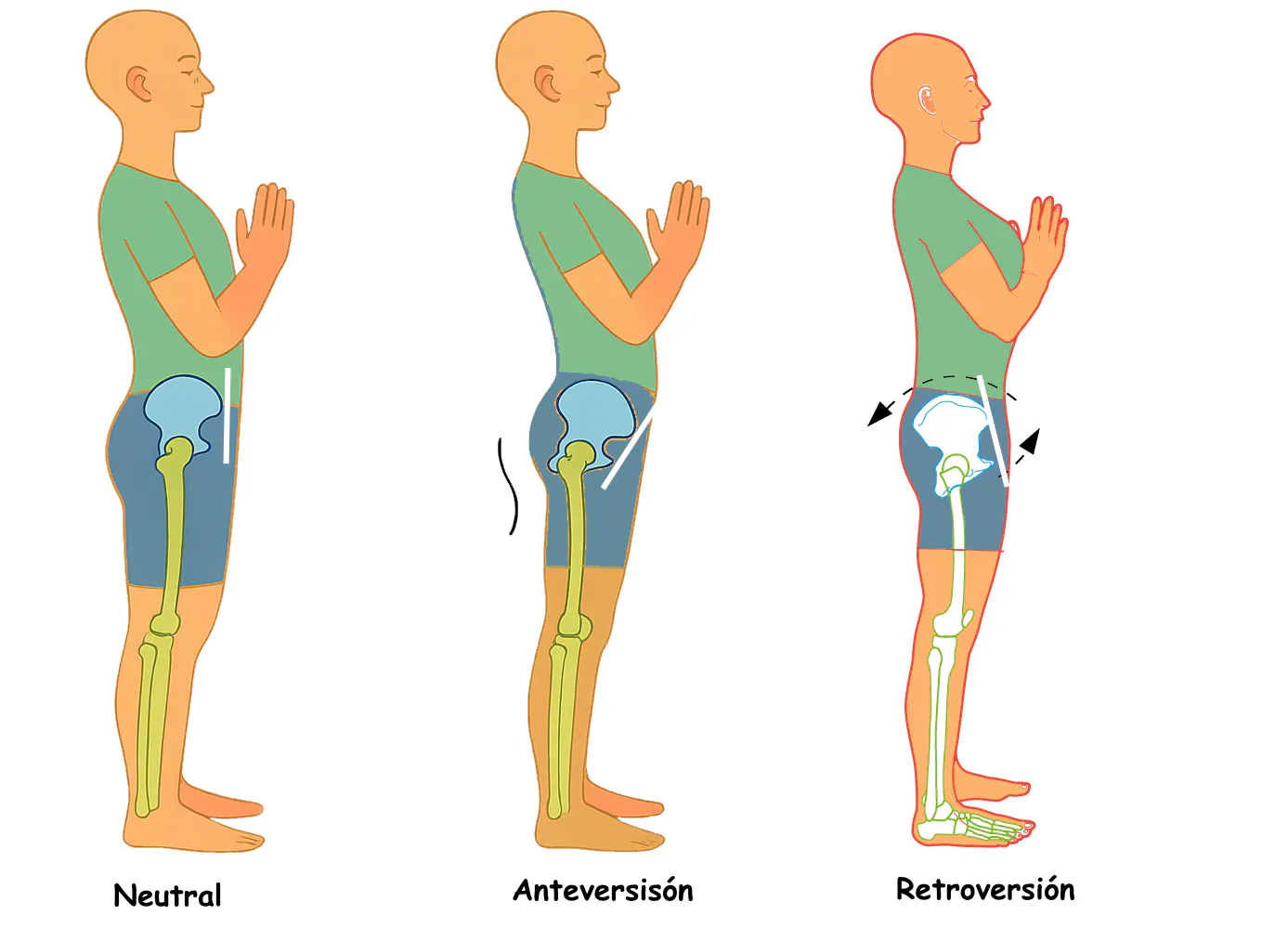 Ejemplo visual de rotación posterior de pelvis